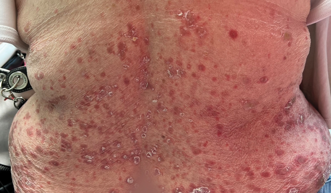 imageye___-_imgi_10_back-before_sotyktu