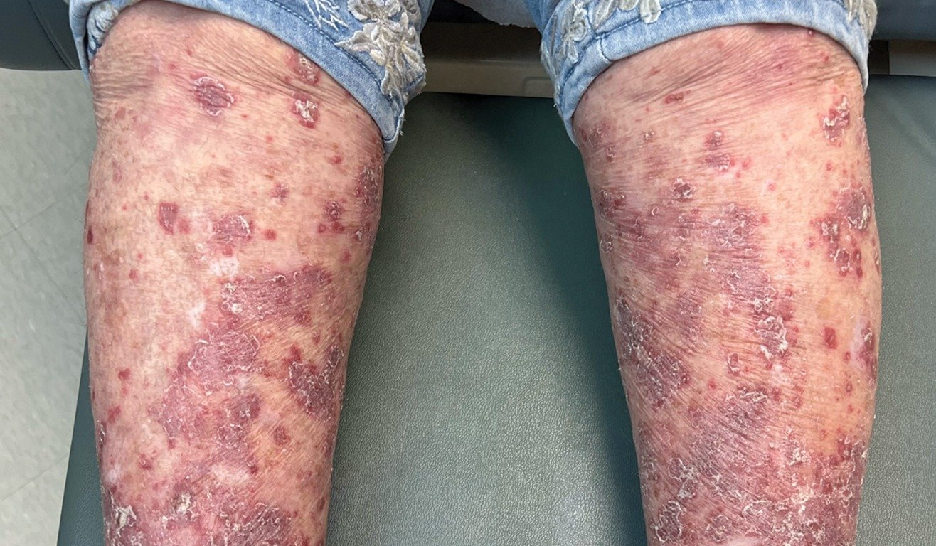 imageye___-_imgi_6_legs-before_sotyktu